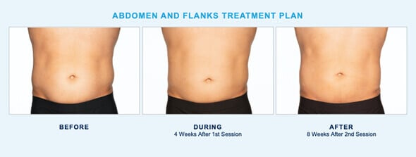 abs and flanks male