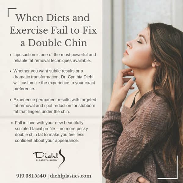 When Diets and Exercise Fail to Fix a Double Chin