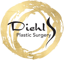Diehl Plastic Surgery - The mons pubis is the area at the pubic bone and  above the labia. The mons can be “puffy” in some patients, giving more  fullness than they would