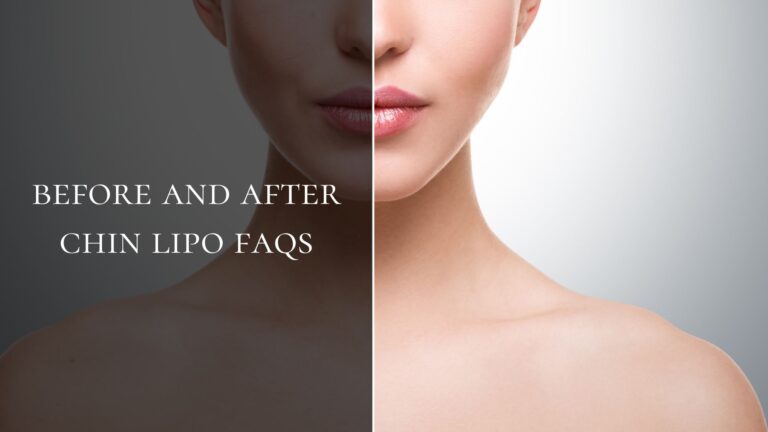Before and After Chin Lipo FAQs
