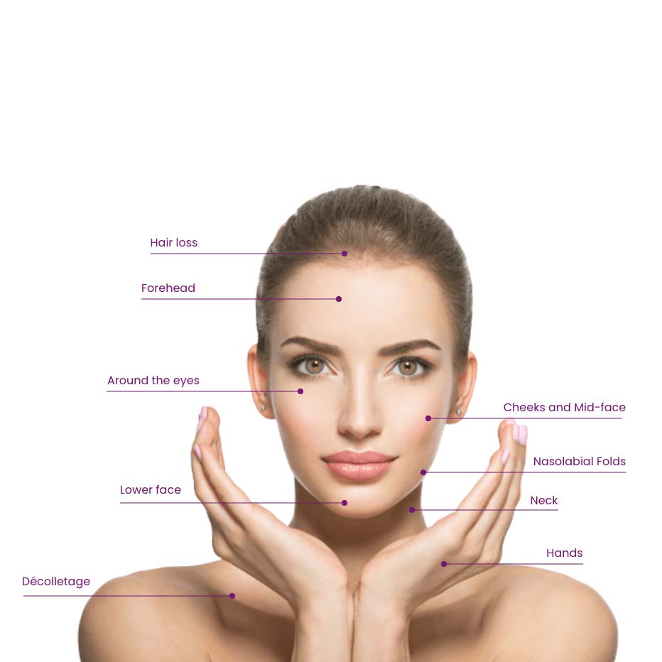 Cellenis PRP Usage Raleigh
