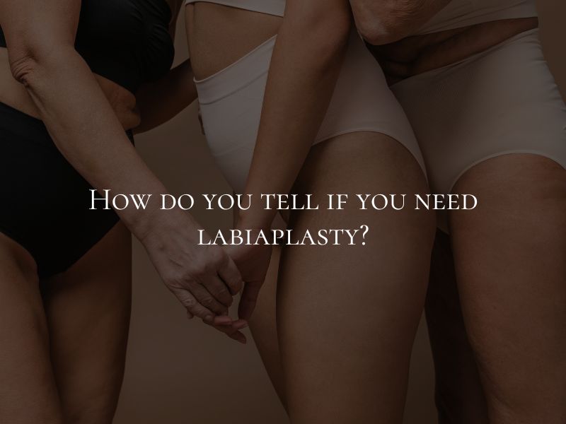 How do you tell if you need labiaplasty