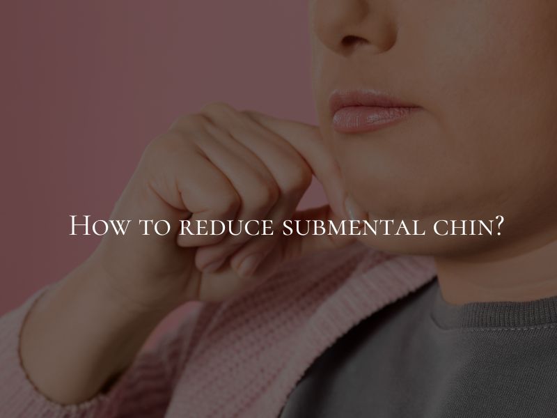 How to reduce submental chin