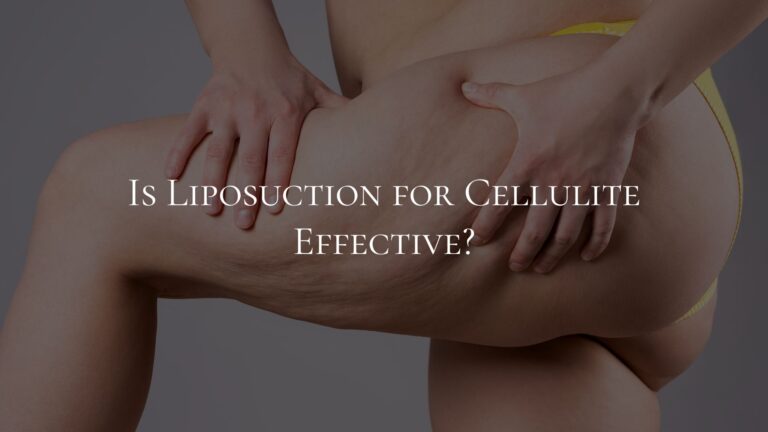 Is Liposuction for Cellulite Effective