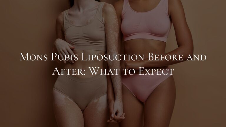 Mons Pubis Liposuction Before and After What to Expect