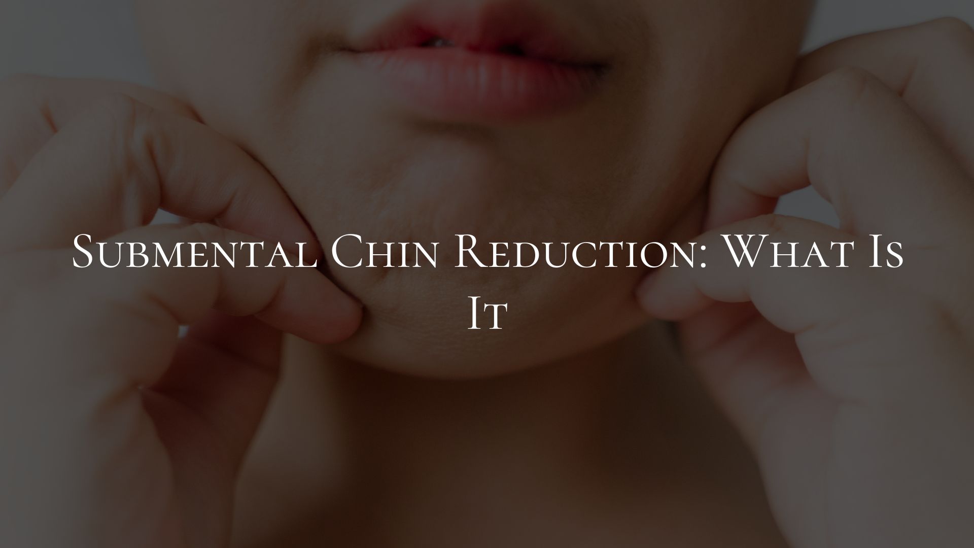 Submental Chin Reduction What Is It