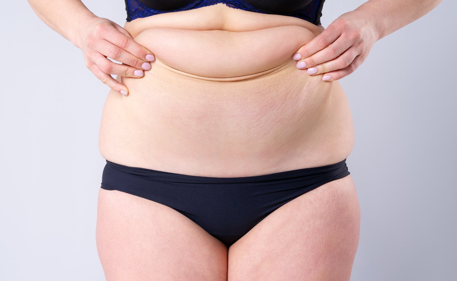 Tummy Tuck Raleigh