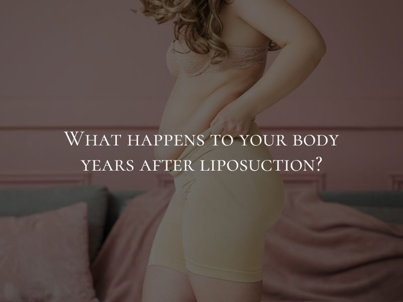 What happens to your body years after liposuction