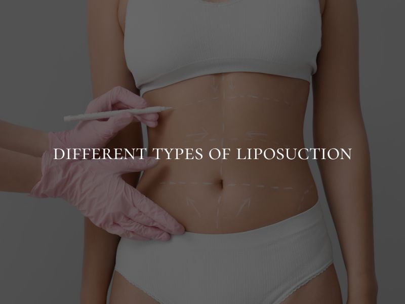 different types of liposuction