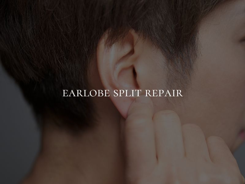 earlobe split repair