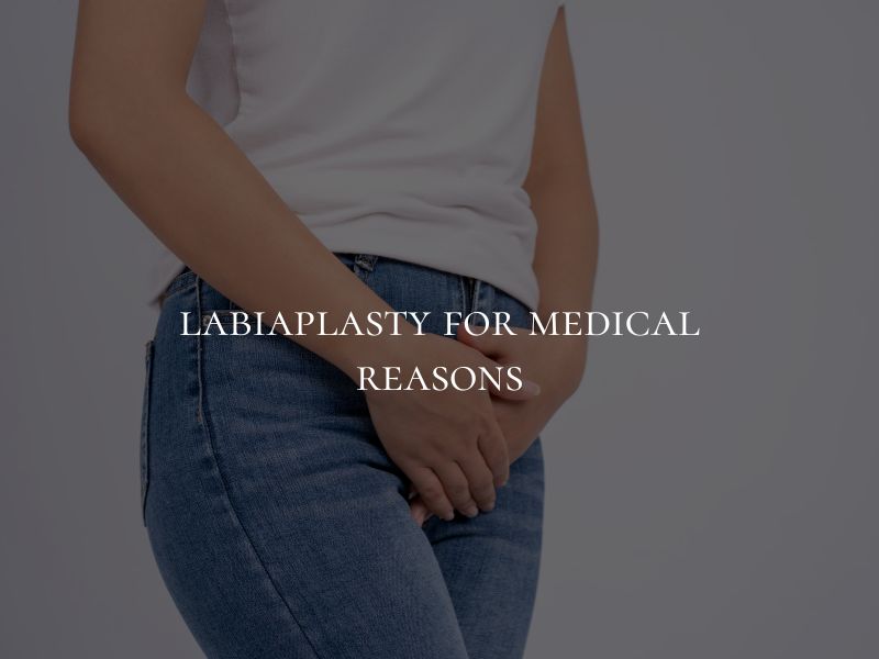 labiaplasty for medical reasons