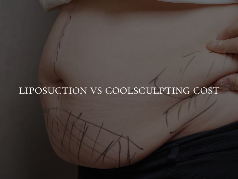 liposuction vs coolsculpting cost