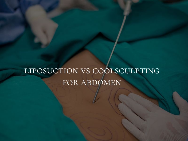 liposuction vs coolsculpting for abdomen