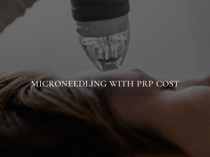 microneedling with prp cost