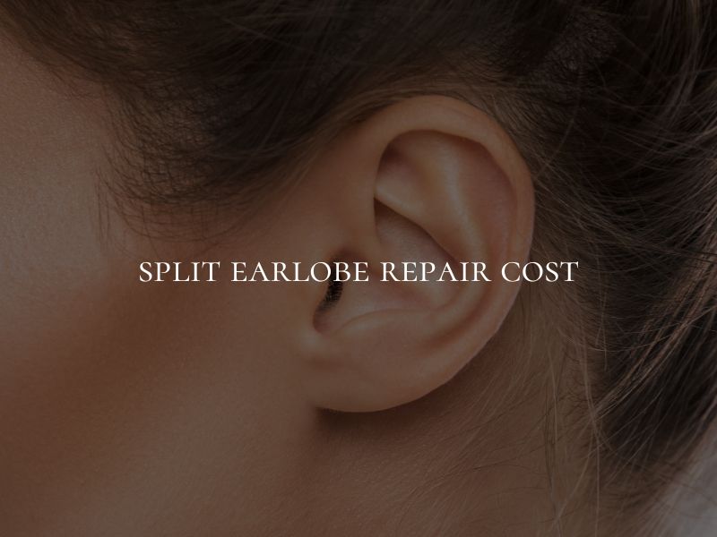 split earlobe repair cost